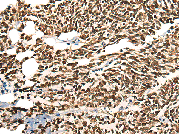 Anti-MORF4L2 Rabbit Polyclonal Antibody