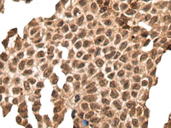 Anti-LINE 1 ORF1p Rabbit Polyclonal Antibody