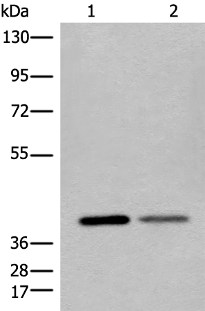 Anti-LINE 1 ORF1p Rabbit Polyclonal Antibody