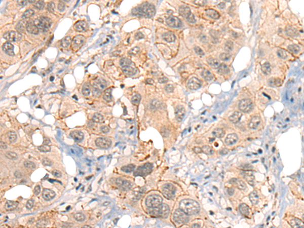 Anti-GPR55 Rabbit Polyclonal Antibody