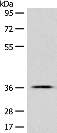 Anti-GPR55 Rabbit Polyclonal Antibody