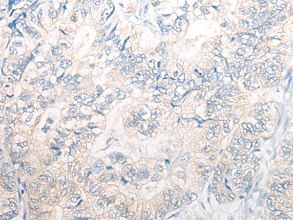 Anti-PNPO Rabbit Polyclonal Antibody
