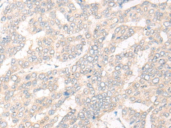 Anti-CYB5D1 Rabbit Polyclonal Antibody