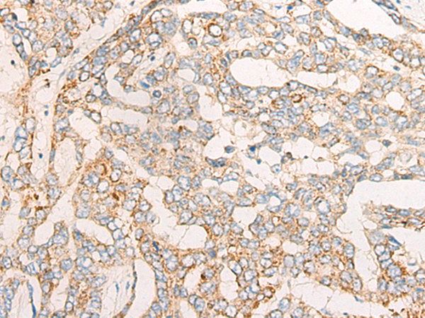 Anti-CYSLTR2 Rabbit Polyclonal Antibody