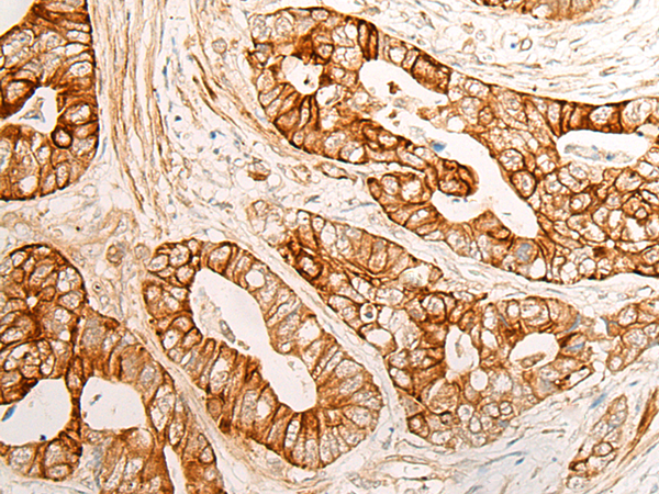 Anti-Cytochrome P450 3A5 Rabbit Polyclonal Antibody