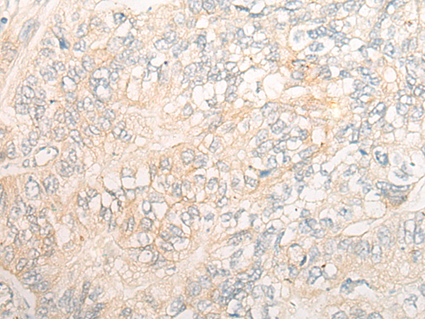 Anti-Deptor Rabbit Polyclonal Antibody