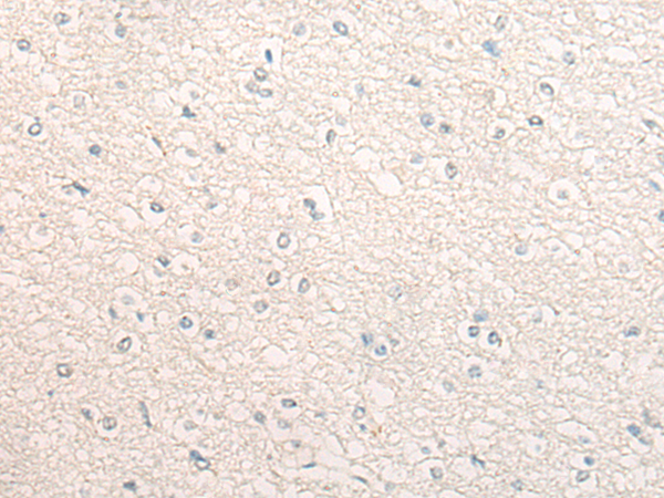 Anti-DLL1 Rabbit Polyclonal Antibody