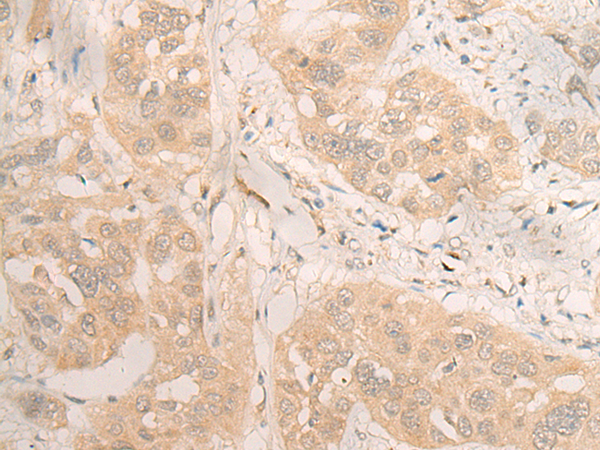 Anti-DMAP1 Rabbit Polyclonal Antibody
