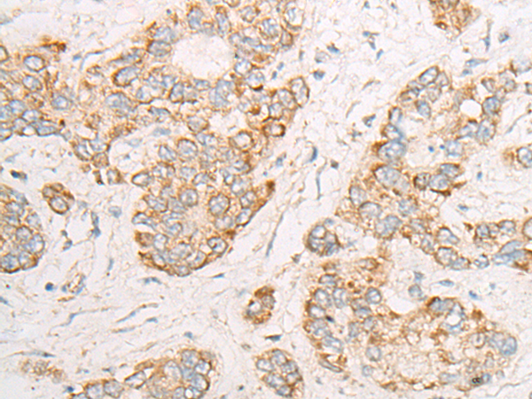 Anti-DYNC1LI2 Rabbit Polyclonal Antibody