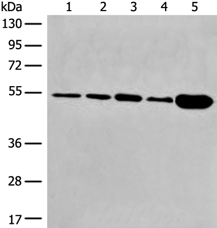 Anti-DYNC1LI2 Rabbit Polyclonal Antibody