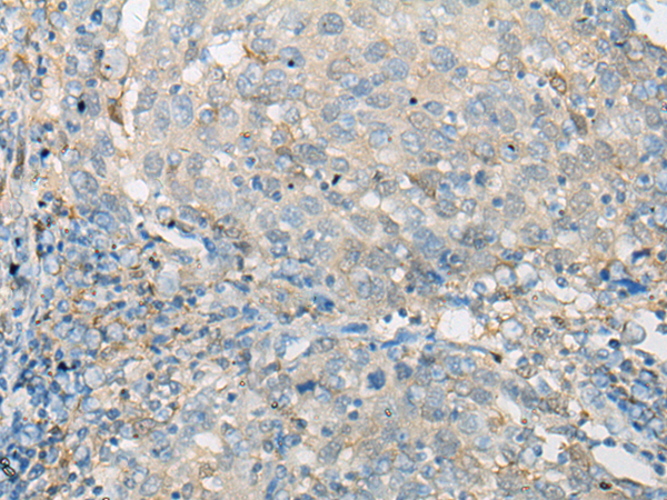 Anti-EFHD2 Rabbit Polyclonal Antibody