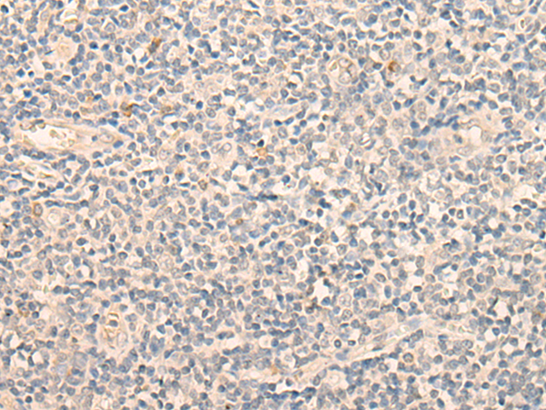 Anti-EHD3 Rabbit Polyclonal Antibody
