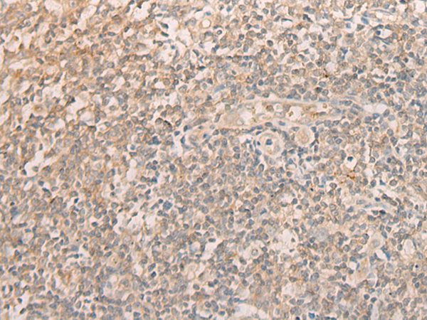 Anti-eIF2S1 Rabbit Polyclonal Antibody