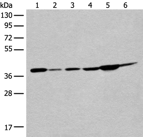 Anti-eIF2S1 Rabbit Polyclonal Antibody