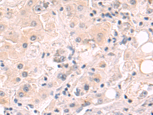Anti-ELMO2 Rabbit Polyclonal Antibody