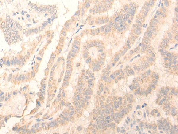 Anti-ADGRE3 Rabbit Polyclonal Antibody