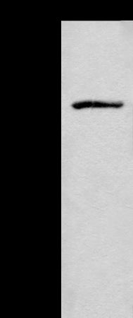 Anti-ADGRE3 Rabbit Polyclonal Antibody