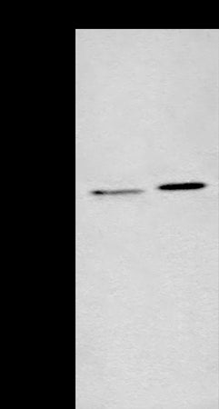 Anti-Transmembrane Protein 192 Rabbit Polyclonal Antibody