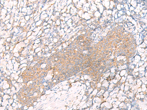 Anti-HLA A Rabbit Polyclonal Antibody