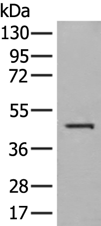 Anti-HLA A Rabbit Polyclonal Antibody