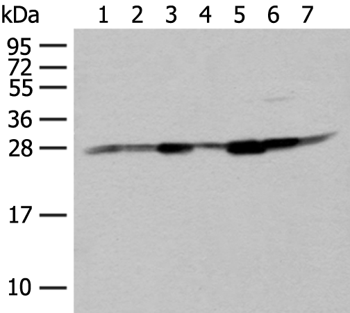 Anti-NIPSNAP2 Rabbit Polyclonal Antibody