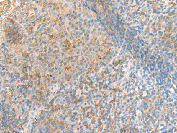 Anti-METTL17 Rabbit Polyclonal Antibody