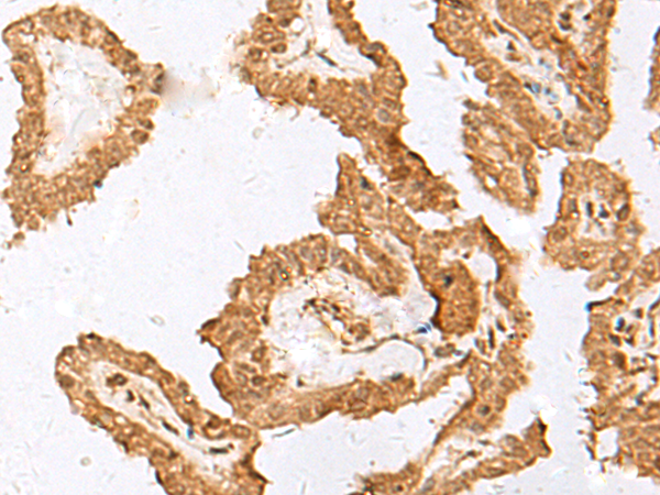Anti-LRATD1 Rabbit Polyclonal Antibody