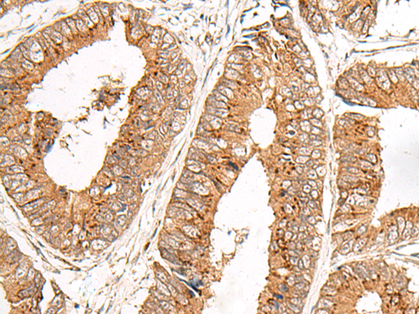 Anti-LRATD2 Rabbit Polyclonal Antibody