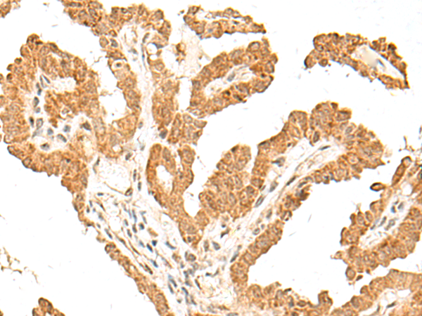 Anti-FANCB Rabbit Polyclonal Antibody