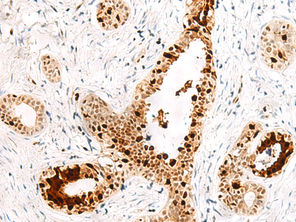 Anti-FKBP5 Rabbit Polyclonal Antibody