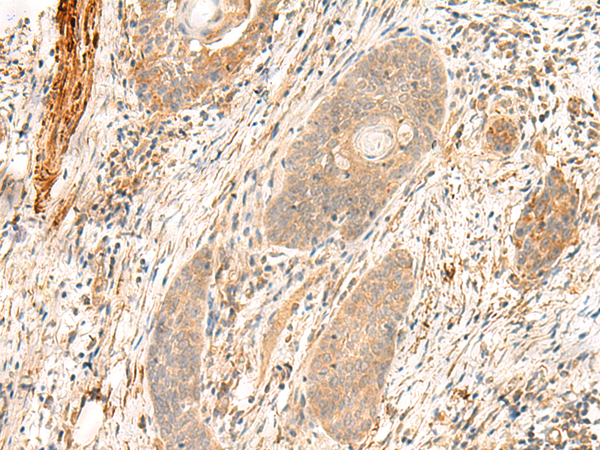 Anti-FLNC Rabbit Polyclonal Antibody