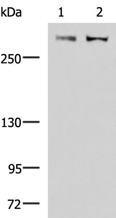Anti-FLNC Rabbit Polyclonal Antibody