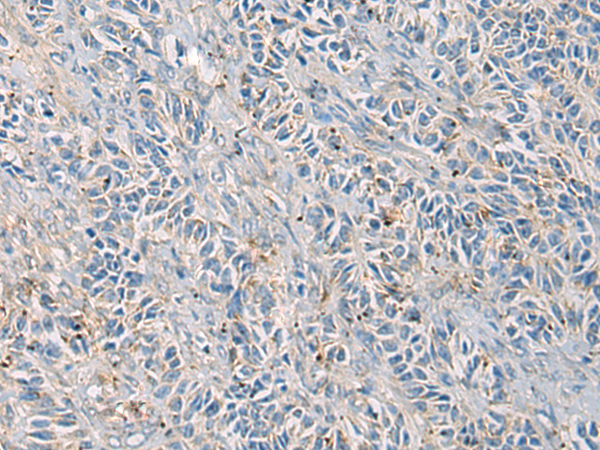 Anti-GAB4 Rabbit Polyclonal Antibody