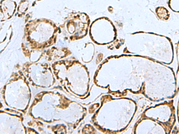 Anti-GABPB1 Rabbit Polyclonal Antibody