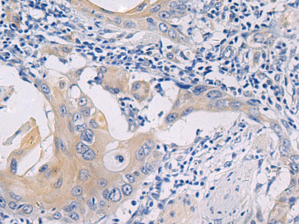 Anti-GALR3 Rabbit Polyclonal Antibody