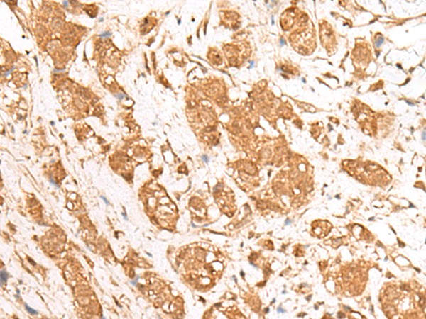 Anti-GANC Rabbit Polyclonal Antibody