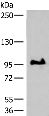 Anti-GANC Rabbit Polyclonal Antibody