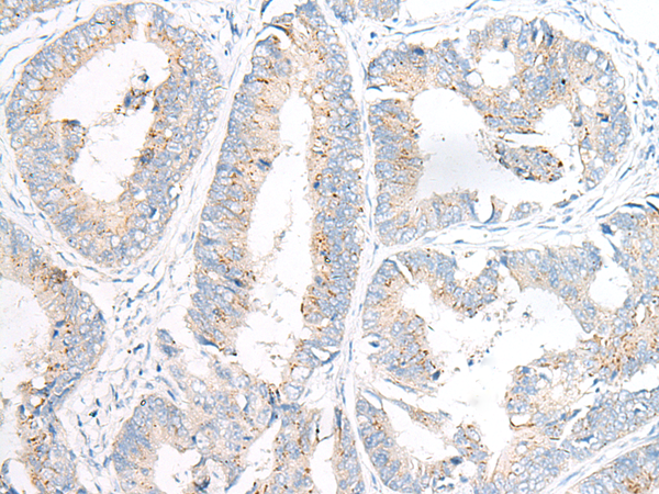 Anti-GARNL3 Rabbit Polyclonal Antibody