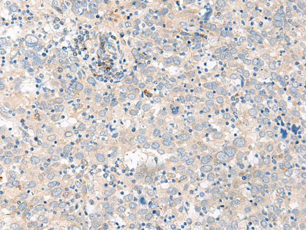 Anti-Guanylate Cyclase Activator 1B Rabbit Polyclonal Antibody