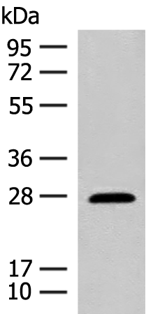 Anti-Guanylate Cyclase Activator 1B Rabbit Polyclonal Antibody
