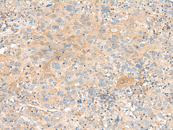 Anti-SERPINA9 Rabbit Polyclonal Antibody