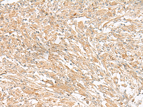 Anti-GIPC1 Rabbit Polyclonal Antibody
