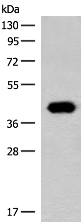 Anti-GIPC1 Rabbit Polyclonal Antibody