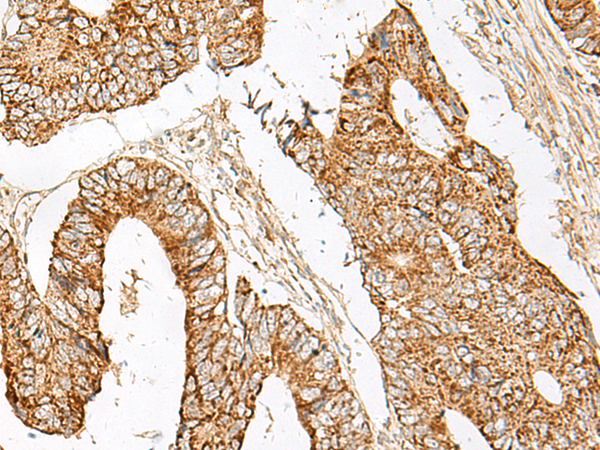 Anti-GNAT1 Rabbit Polyclonal Antibody