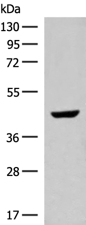 Anti-GNAT1 Rabbit Polyclonal Antibody