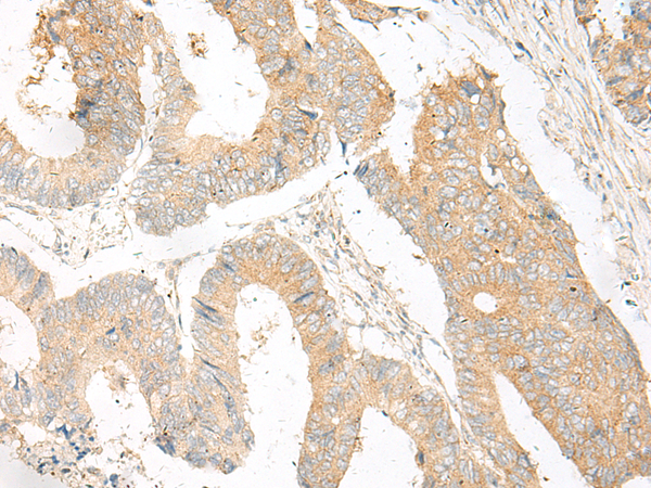 Anti-GOLGA3 Rabbit Polyclonal Antibody
