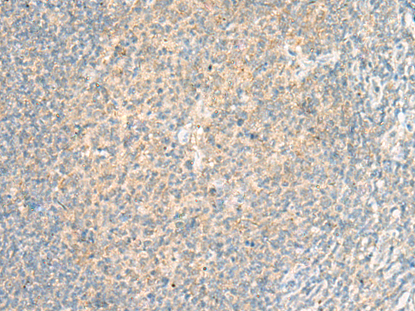 Anti-ADGRF5 Rabbit Polyclonal Antibody