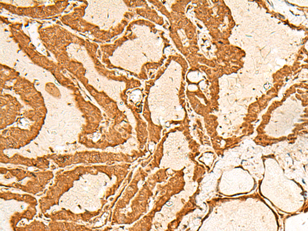 Anti-CHP1 Rabbit Polyclonal Antibody