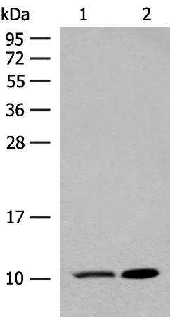 Anti-RPS28 Rabbit Polyclonal Antibody