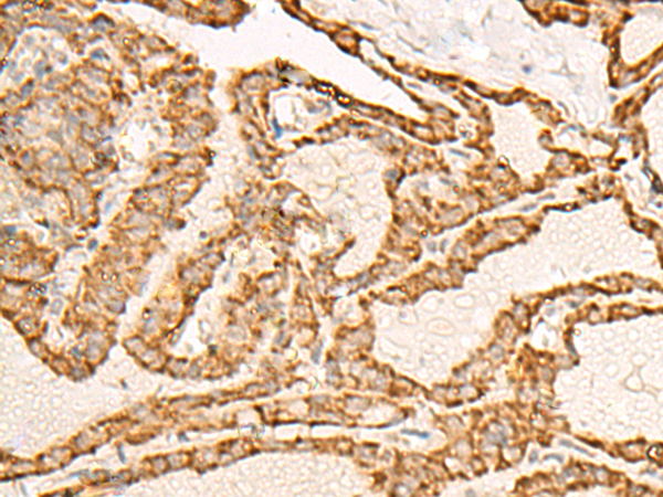 Anti-ATP5ME Rabbit Polyclonal Antibody